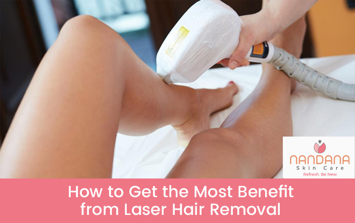 How to Get the Most Benefit from Laser Hair Removal